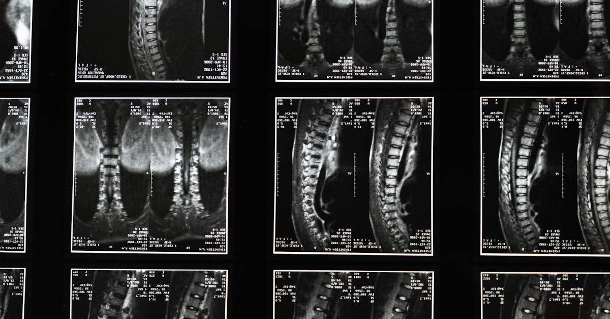 medical images of the backbone